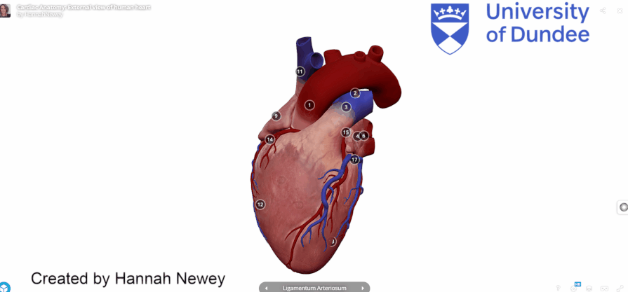 University of Dundee Interactive Heart